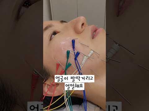 화명동 한가온한의원 정안침 후기 #정안침 #동안침 #화명동한의원 #한가온한의원