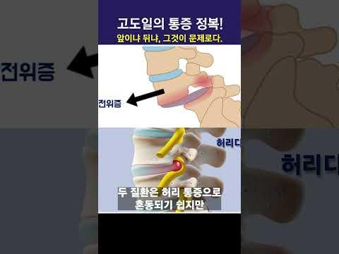허리 통증, 앞이냐? 뒤냐? 그것이 문제 로다.